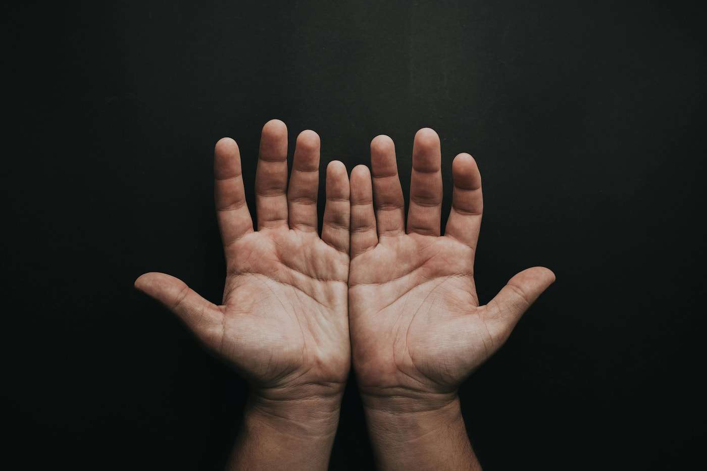 Zniszczona skóra dłoni – 8 sygnałów, których&nbsp;nie&nbsp;warto ignorować